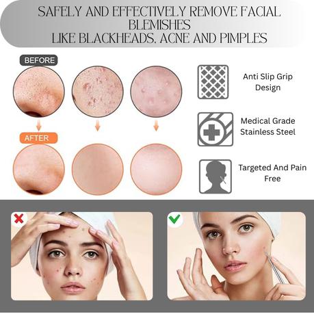 Bestby 14 Piece Stainless Steel Acne Blackhead Pimple Removal Set with Case - Image 5